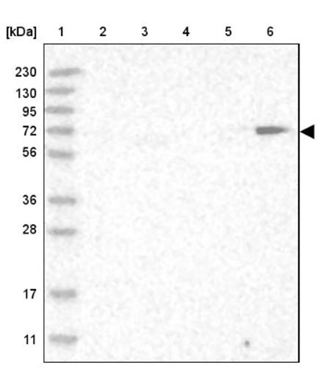 Western Blot: ZCPW1 Antibody [NBP1-87997] - Lane 1: Marker [kDa] 230, 130, 95, 72, 56, 36, 28, 17, 11<br/>Lane 2: Human cell line RT-4<br/>Lane 3: Human cell line U-251MG sp<br/>Lane 4: Human plasma (IgG/HSA depleted)<br/>Lane 5: Human liver tissue<br/>Lane 6: Human tonsil tissue