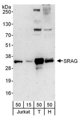 Detection of human SRAG by western blot.