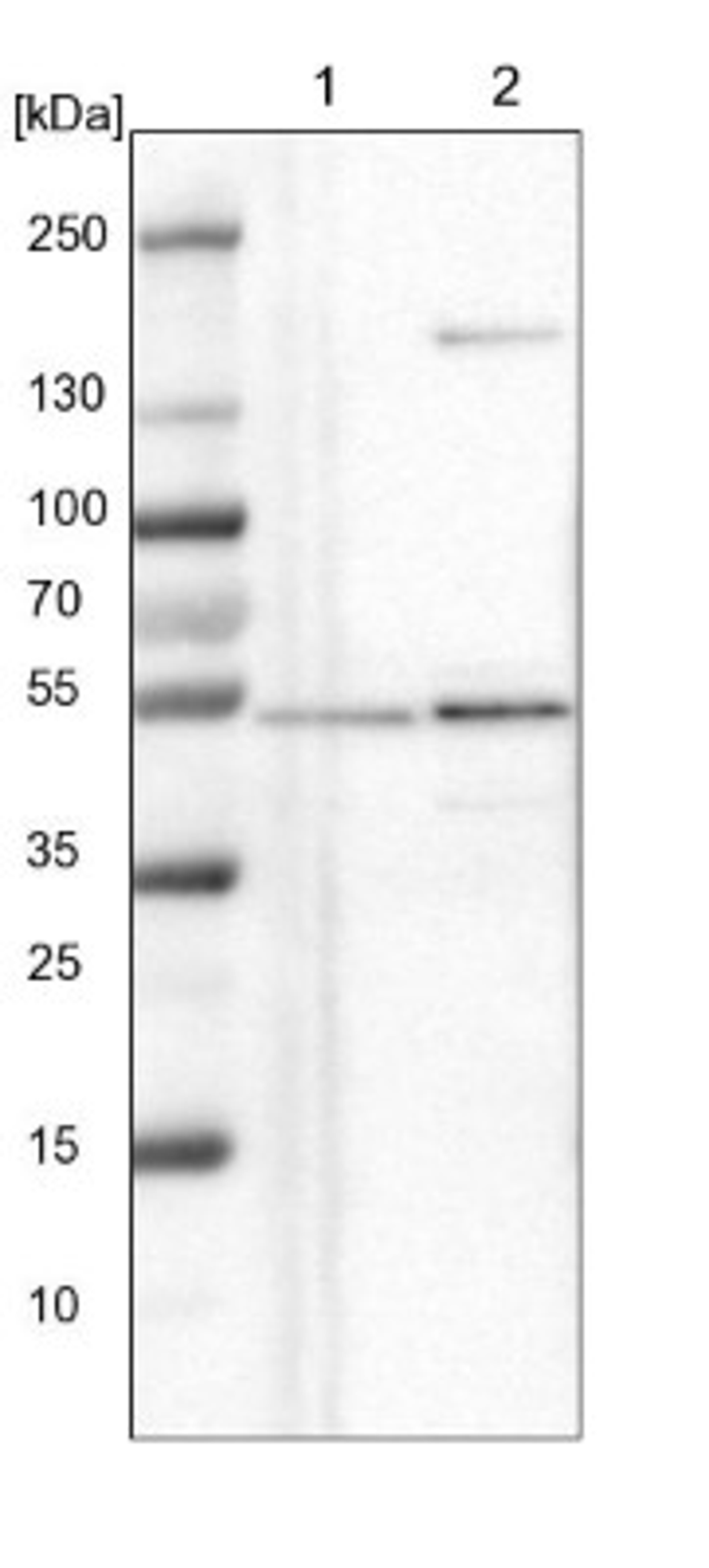 Western Blot: NLE1 Antibody [NBP1-83860] - Lane 1: NIH-3T3 cell lysate (Mouse embryonic fibroblast cells)<br/>Lane 2: NBT-II cell lysate (Rat Wistar bladder tumour cells)