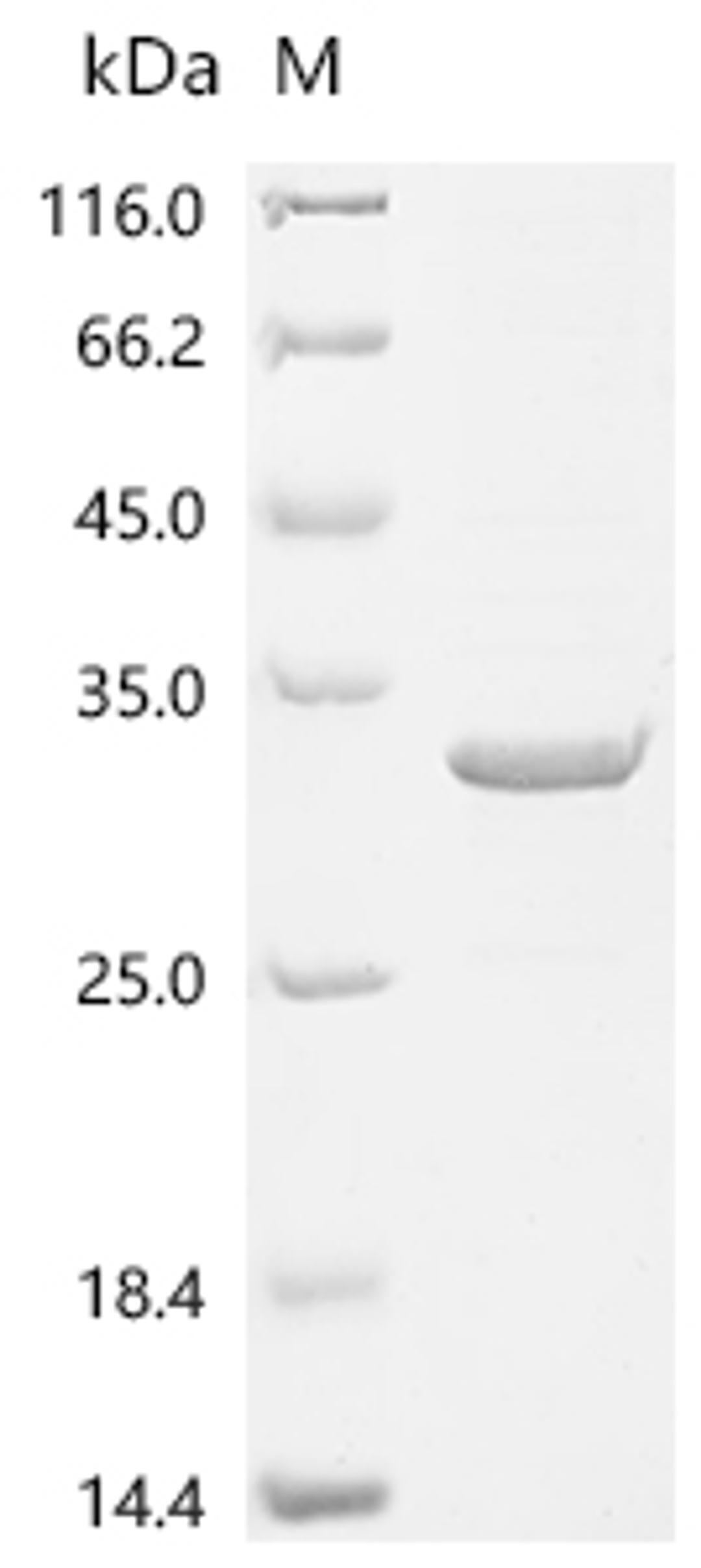 (Tris-Glycine gel) Discontinuous SDS-PAGE (reduced) with 5% enrichment gel and 15% separation gel.