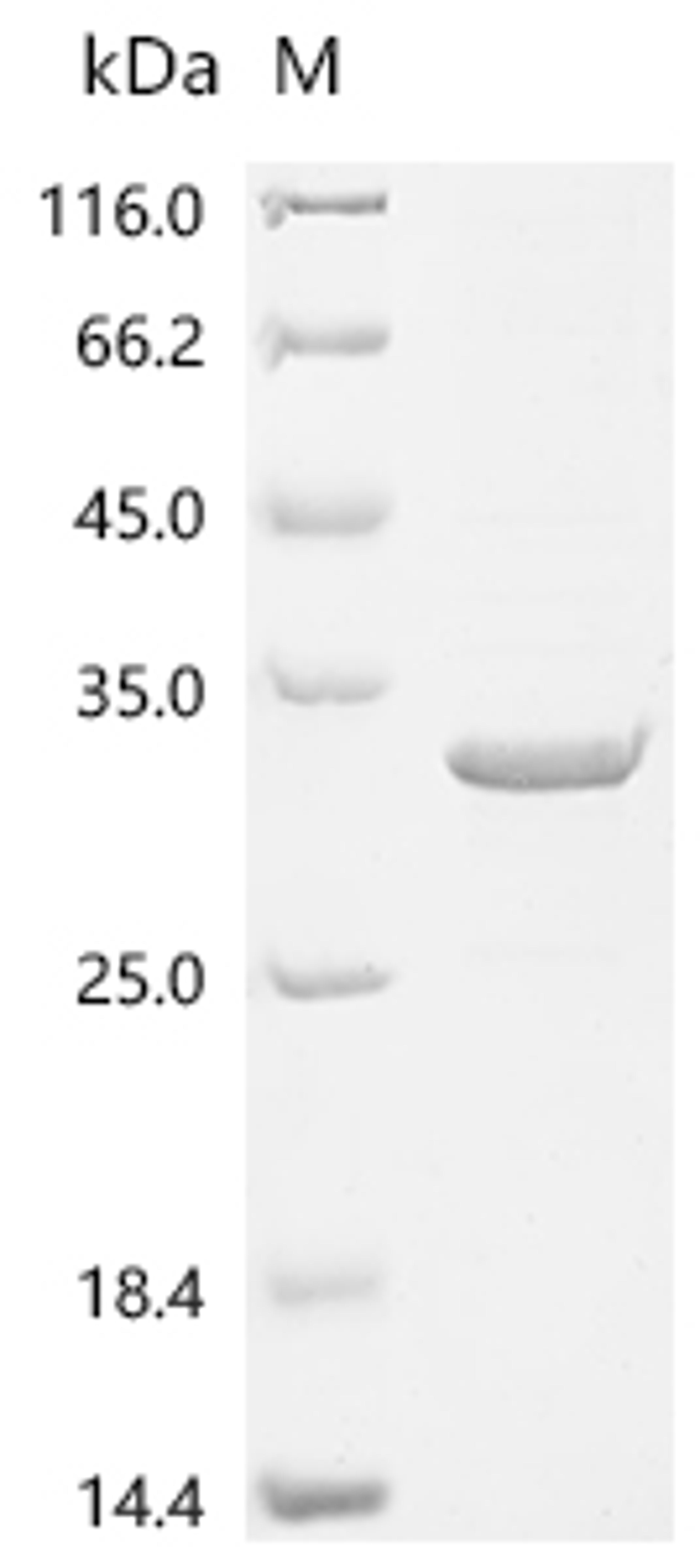 (Tris-Glycine gel) Discontinuous SDS-PAGE (reduced) with 5% enrichment gel and 15% separation gel.