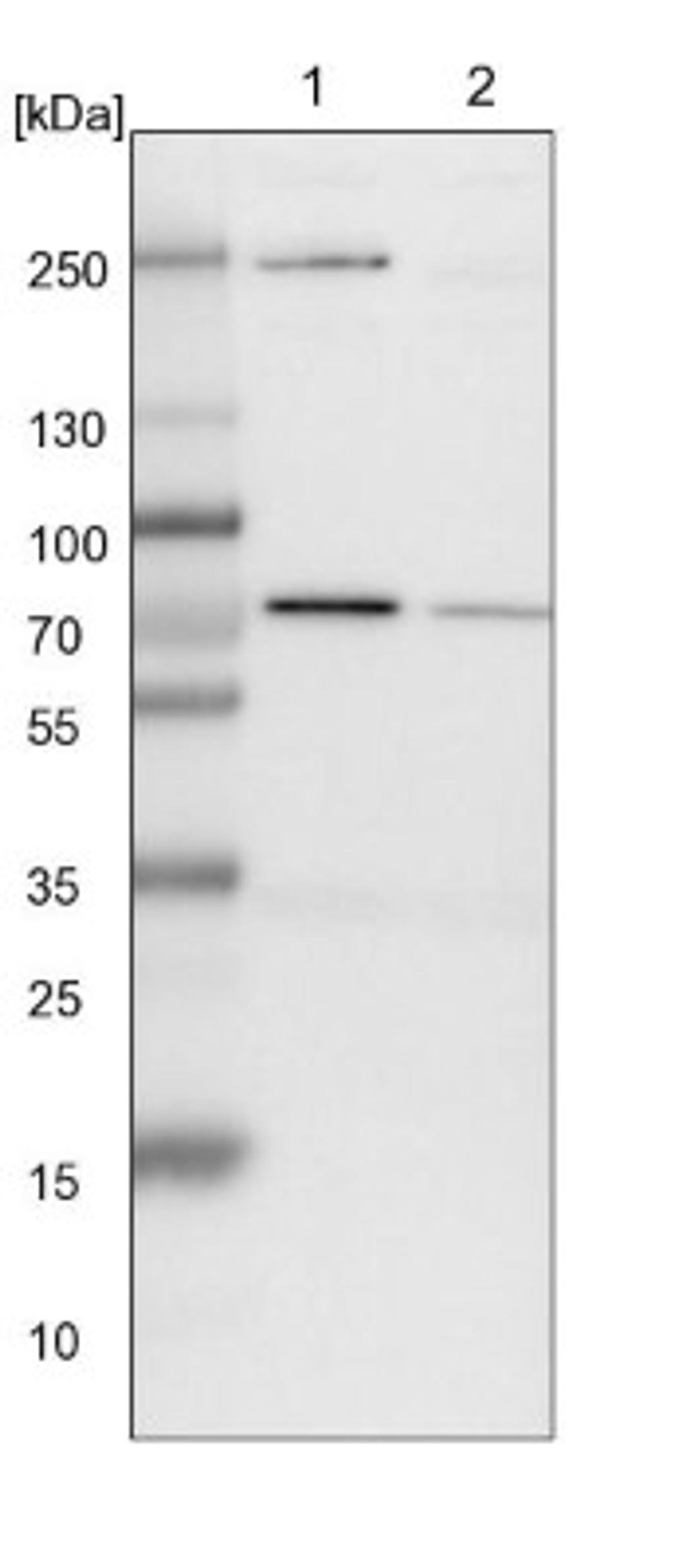 Western Blot: SLC25A12 Antibody [NBP1-89020] - Lane 1: NIH-3T3 cell lysate (Mouse embryonic fibroblast cells)<br/>Lane 2: NBT-II cell lysate (Rat Wistar bladder tumour cells)