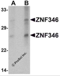 Western blot analysis of ZNF346 in human kidney tissue lysate with ZNF346 antibody at (A) 1 and (B) 2 μg/mL.