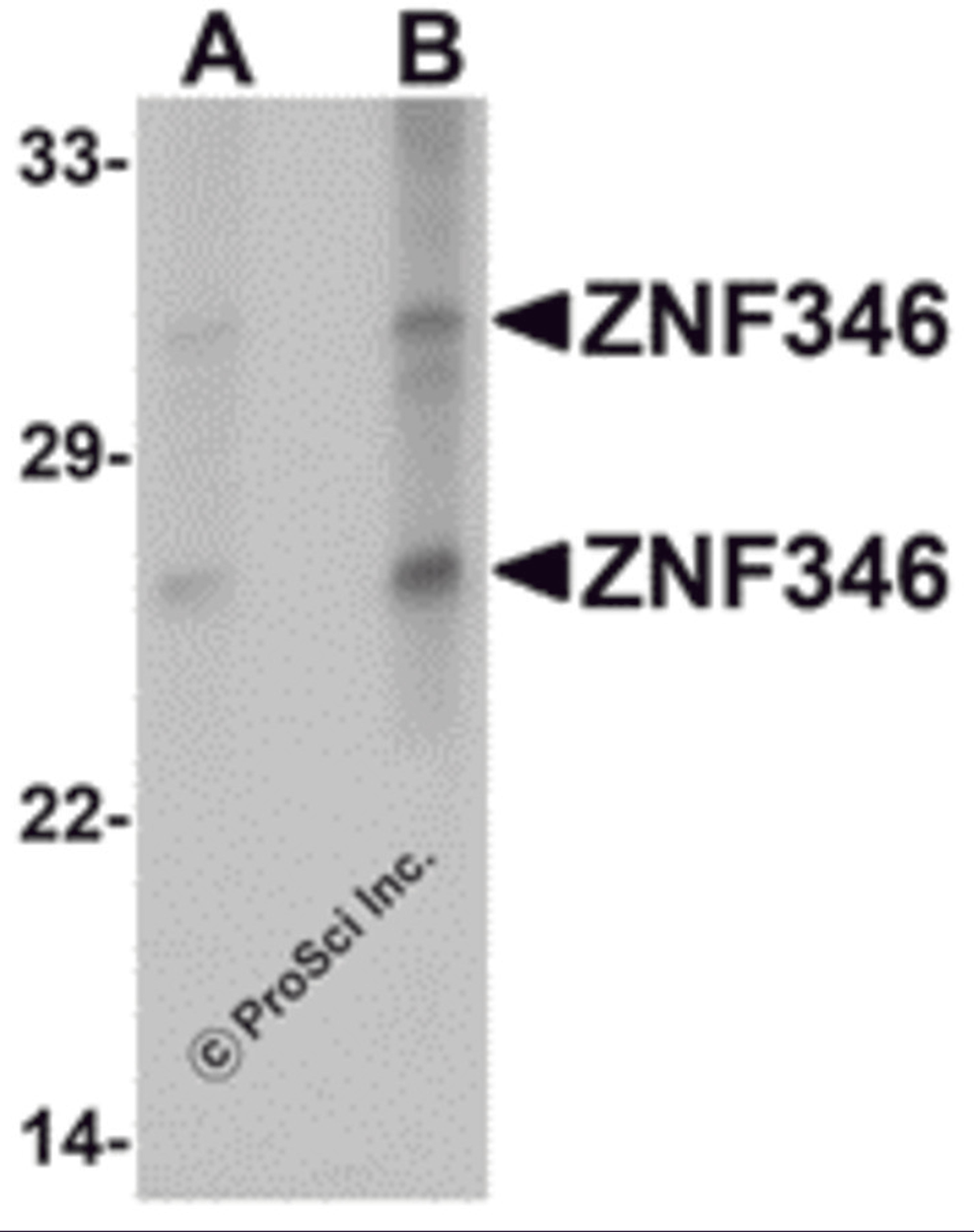 Western blot analysis of ZNF346 in human kidney tissue lysate with ZNF346 antibody at (A) 1 and (B) 2 μg/mL.