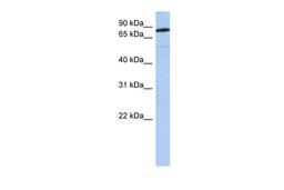 Antibody used in WB on Human Brain at 0.2-1 ug/ml.