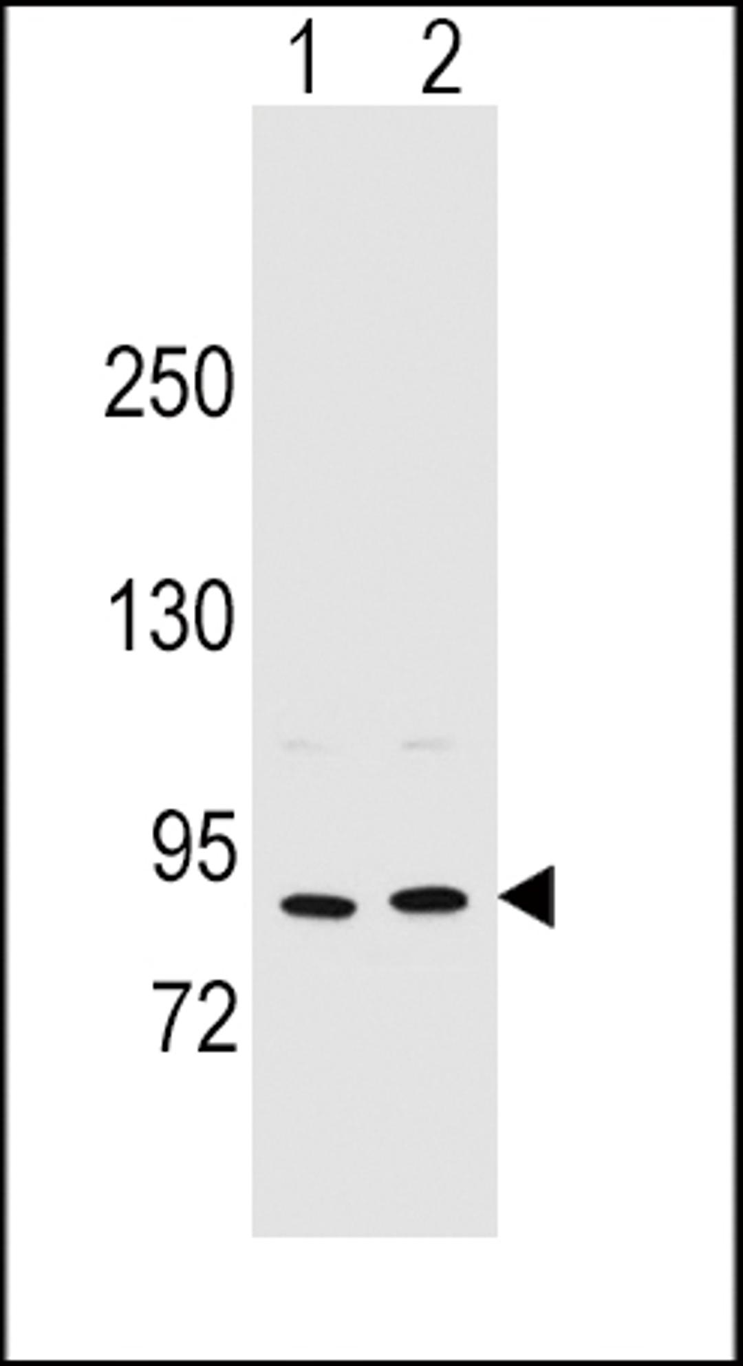 Western blot analysis in MCF-7(lane 1),A375(lane 2) cell line lysates (35ug/lane).