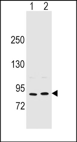 Western blot analysis in MCF-7(lane 1),A375(lane 2) cell line lysates (35ug/lane).