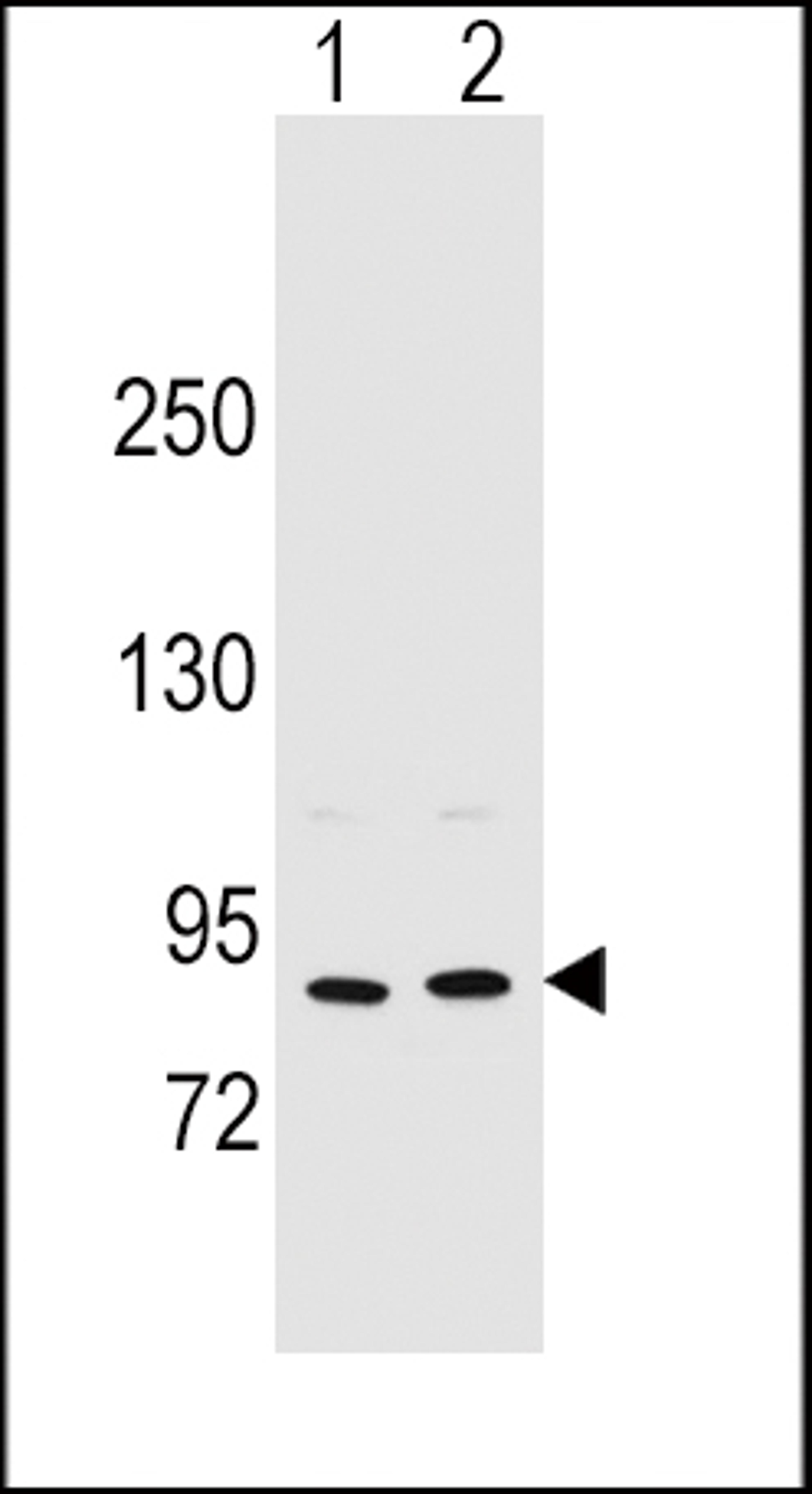 Western blot analysis in MCF-7(lane 1),A375(lane 2) cell line lysates (35ug/lane).