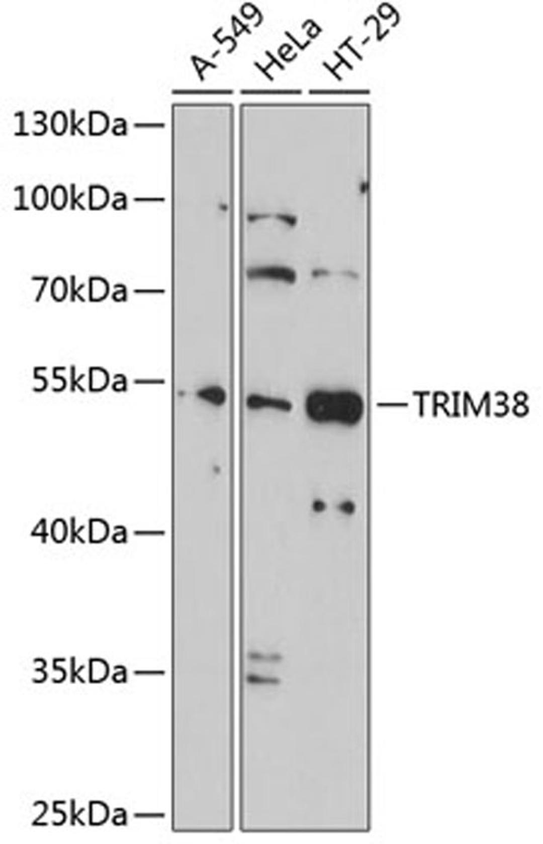 Western blot - TRIM38 antibody (A2600)