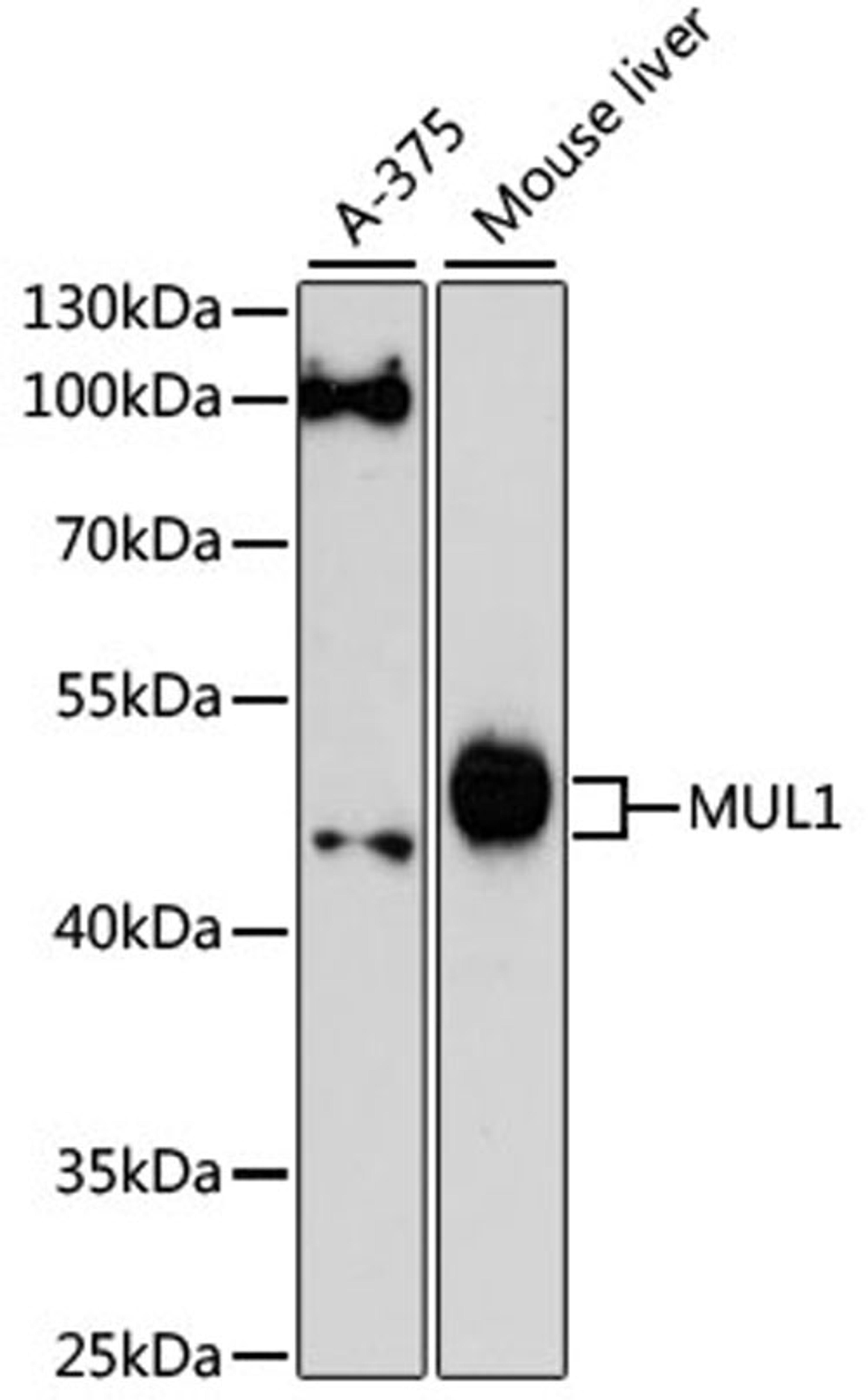 Western blot - MUL1 antibody (A13125)