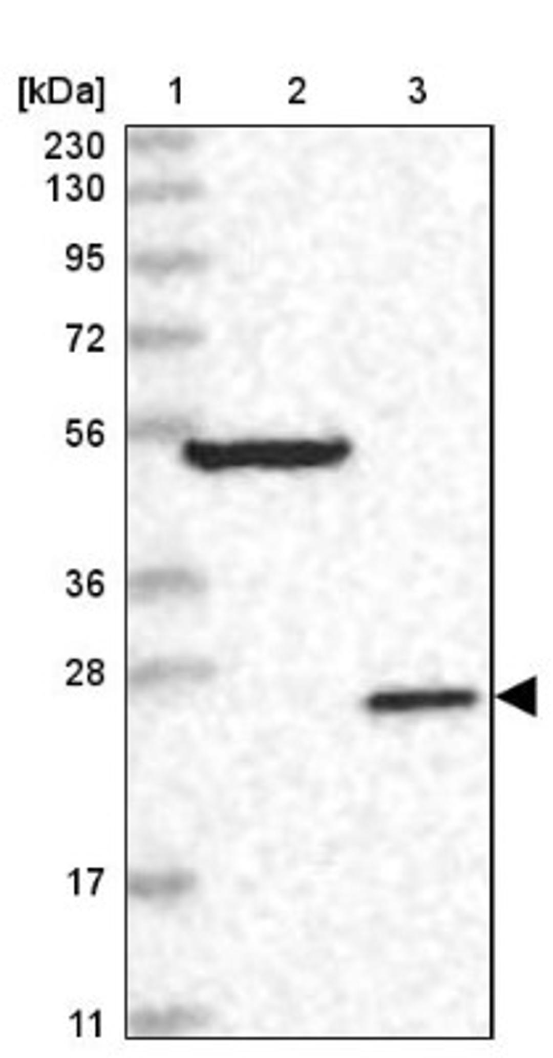 Western Blot: DKFZp566F084 Antibody [NBP2-38312] - Lane 1: Marker [kDa] 230, 130, 95, 72, 56, 36, 28, 17, 11<br/>Lane 2: RT-4<br/>Lane 3: U-251 MG