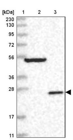 Western Blot: DKFZp566F084 Antibody [NBP2-38312] - Lane 1: Marker [kDa] 230, 130, 95, 72, 56, 36, 28, 17, 11<br/>Lane 2: RT-4<br/>Lane 3: U-251 MG