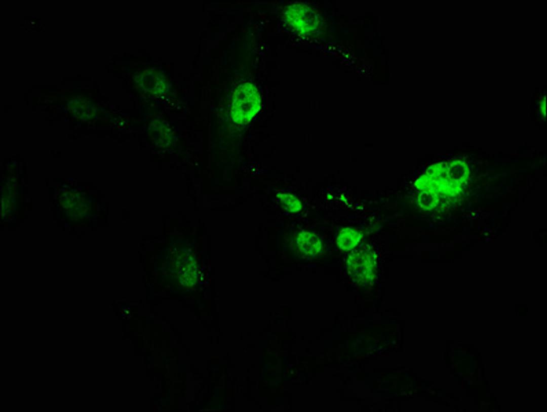 Immunofluorescence staining of U251 cells with CSB-PA019092HA01HU at 1:166, counter-stained with DAPI. The cells were fixed in 4% formaldehyde, permeabilized using 0.2% Triton X-100 and blocked in 10% normal Goat Serum. The cells were then incubated with the antibody overnight at 4°C. The secondary antibody was Alexa Fluor 488-congugated AffiniPure Goat Anti-Rabbit IgG(H+L).