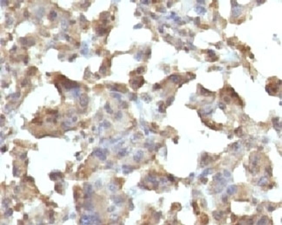 IHC testing of FFPE human histiocytoma and TNF alpha antibody (clone TMDa1-1)