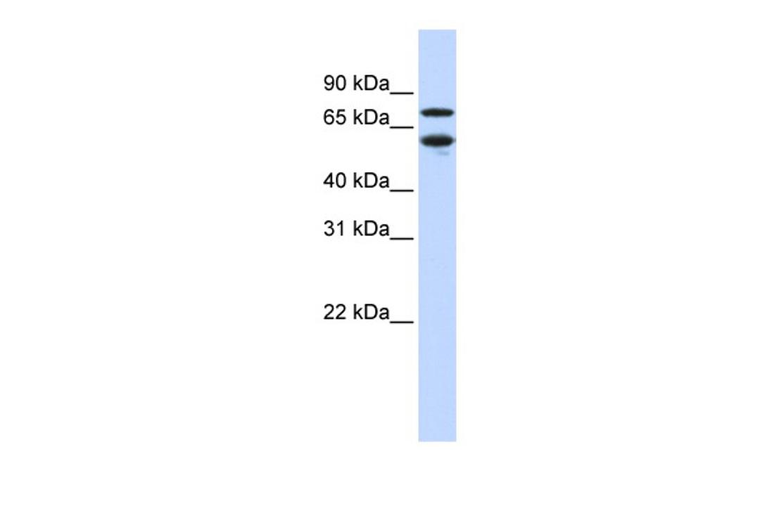 Antibody used in WB on Human Jurkat cells at 0.2-1 ug/ml.