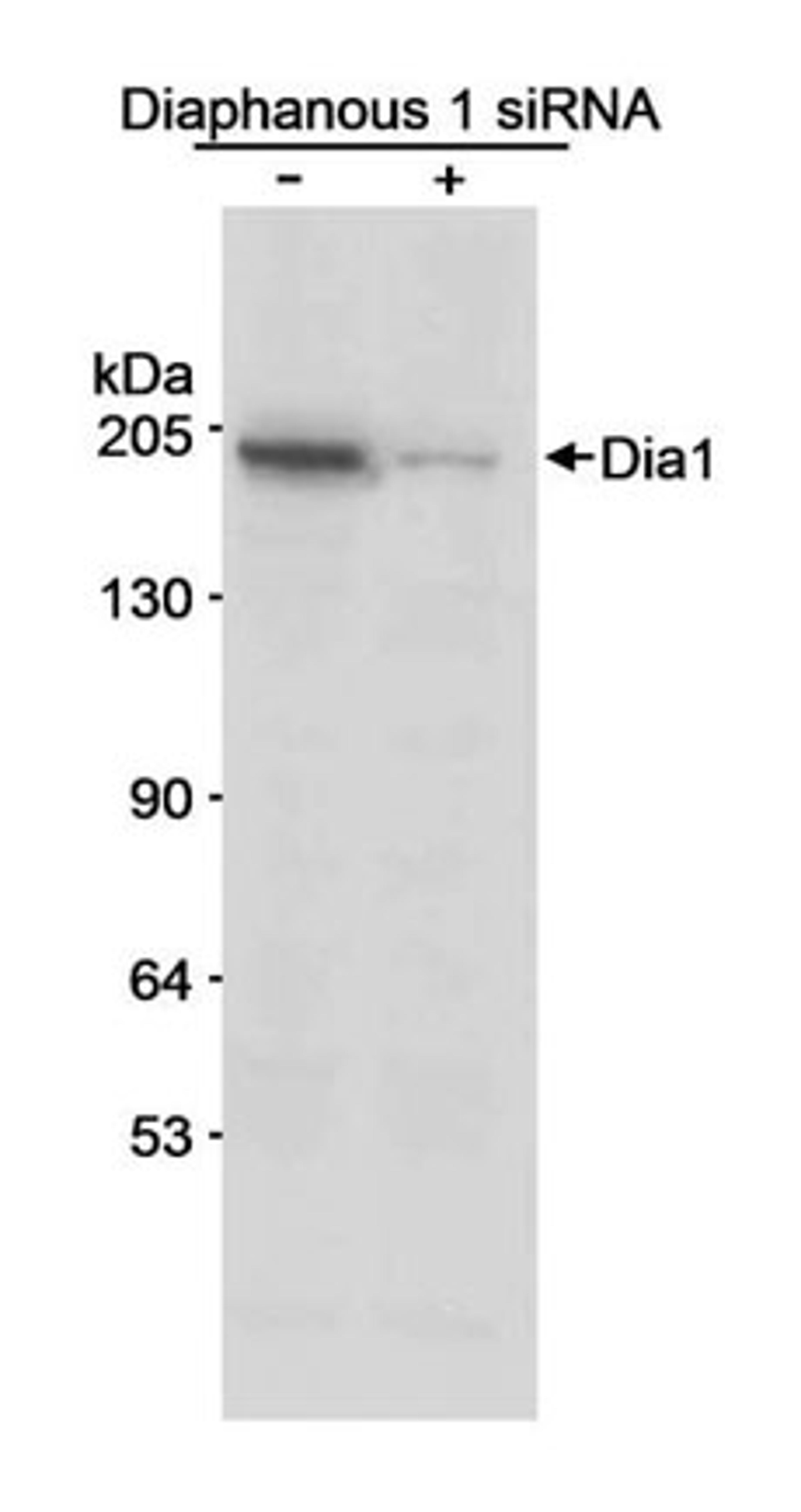 Detection of human Diaphanous 1 by western blot.