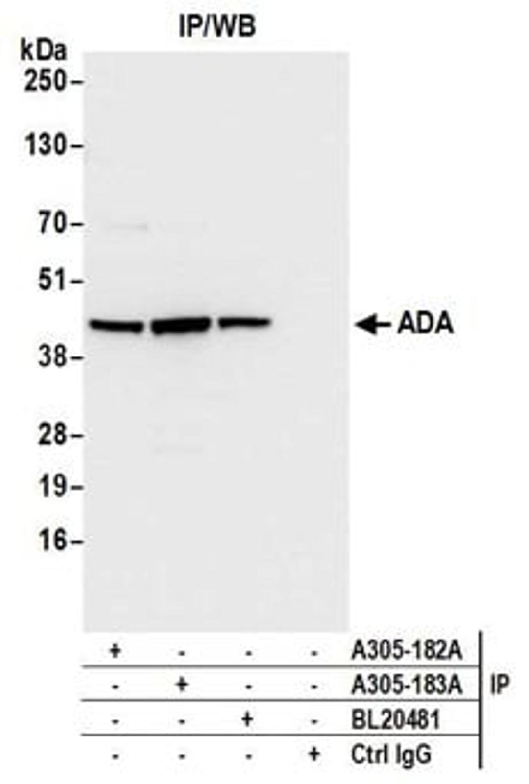 Detection of human ADA by western blot of immunoprecipitates.