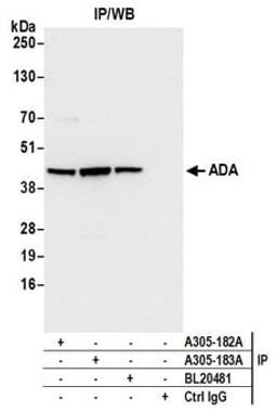 Detection of human ADA by western blot of immunoprecipitates.