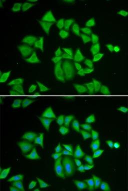 Immunofluorescense analysis of A549 cell lysates using GSTM2 antibody