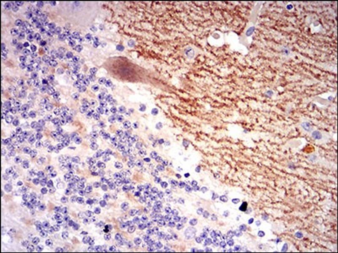 Immunohistochemistry: GABA-B R2 Antibody (5G7F7) [NBP2-37281] - Immunohistochemical analysis of paraffin-embedded cerebellum tissues using GABBR2 mouse mAb with DAB staining.