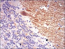 Immunohistochemistry: GABA-B R2 Antibody (5G7F7) [NBP2-37281] - Immunohistochemical analysis of paraffin-embedded cerebellum tissues using GABBR2 mouse mAb with DAB staining.