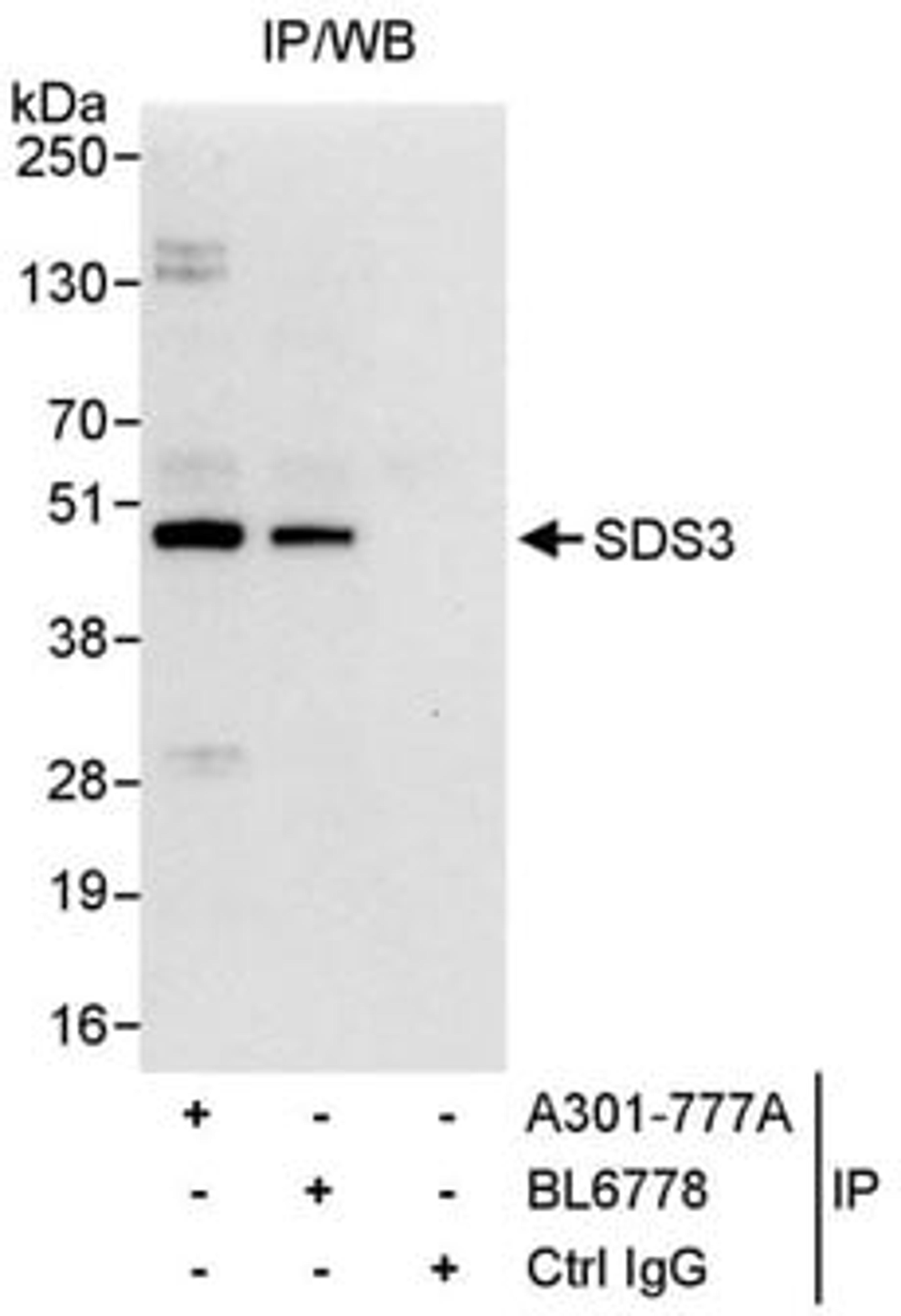 Detection of human SDS3 by western blot of immunoprecipitates.