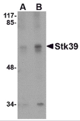 Western blot analysis of Stk39 in SK-N-SH cell lysate with Stk39 antibody at (A) 1 and (B) 2 &#956;g/mL.