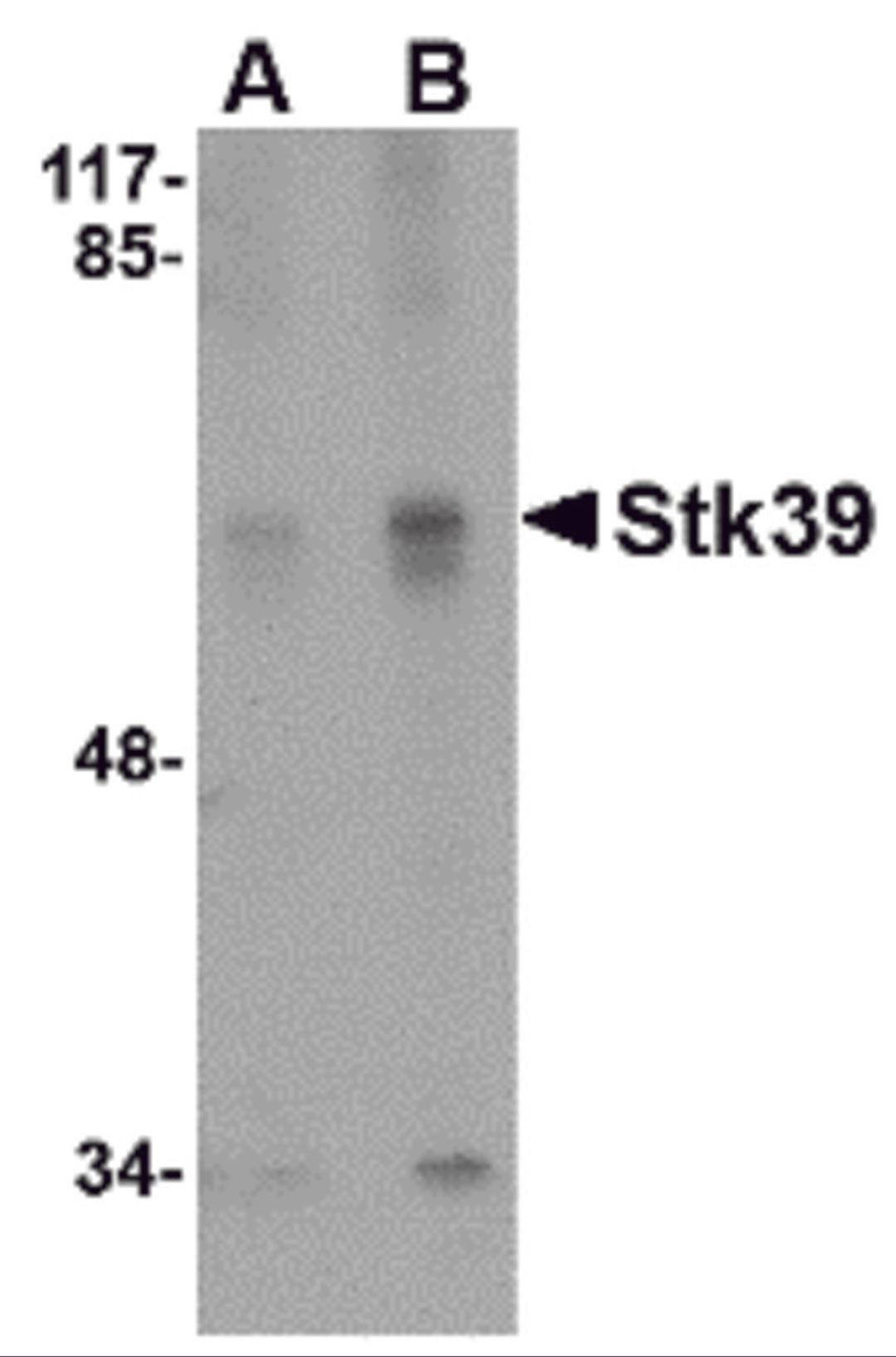 Western blot analysis of Stk39 in SK-N-SH cell lysate with Stk39 antibody at (A) 1 and (B) 2 μg/mL.