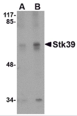 Western blot analysis of Stk39 in SK-N-SH cell lysate with Stk39 antibody at (A) 1 and (B) 2 μg/mL.