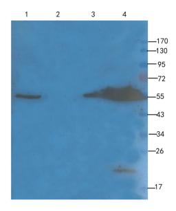 Western blot analysis of rat uterus (lane 1), mouse uterus (lane 2), rat bone marrow (lane 3), rat spleen (lane 4) using Ly-6G antibody (1 ug/ml)