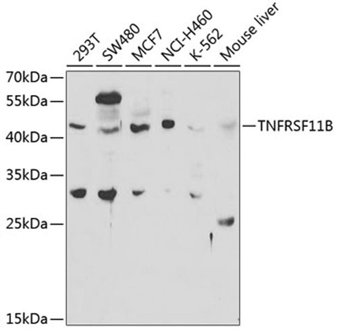 Western blot - TNFRSF11B antibody (A2100)