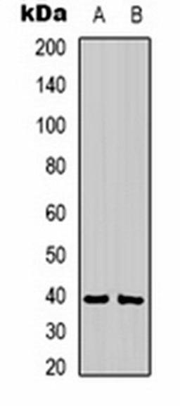 Western blot analysis of mouse brain (Lane 1), rat brain (Lane 2) whole cell lysates using CABP1 antibody