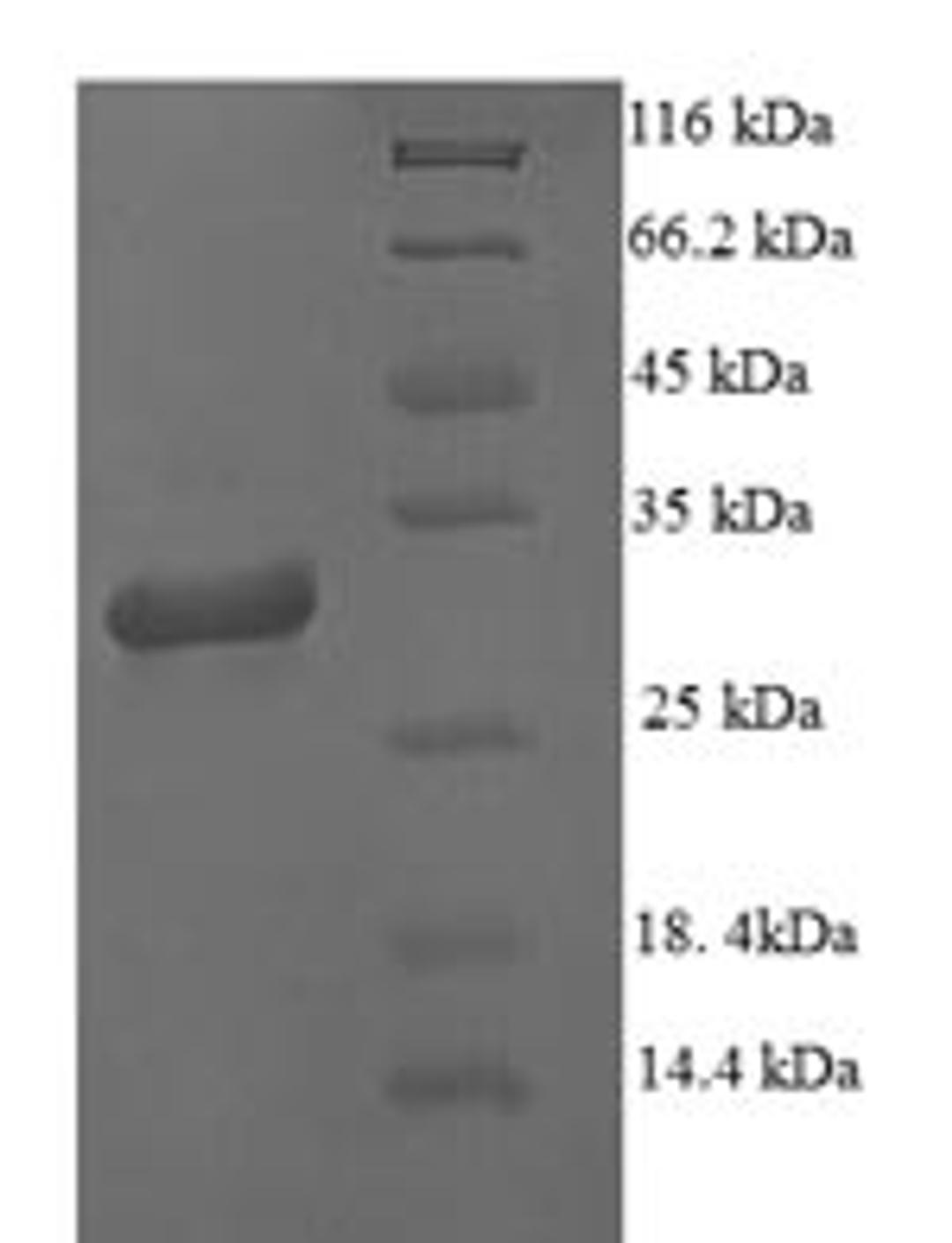 (Tris-Glycine gel) Discontinuous SDS-PAGE (reduced) with 5% enrichment gel and 15% separation gel.