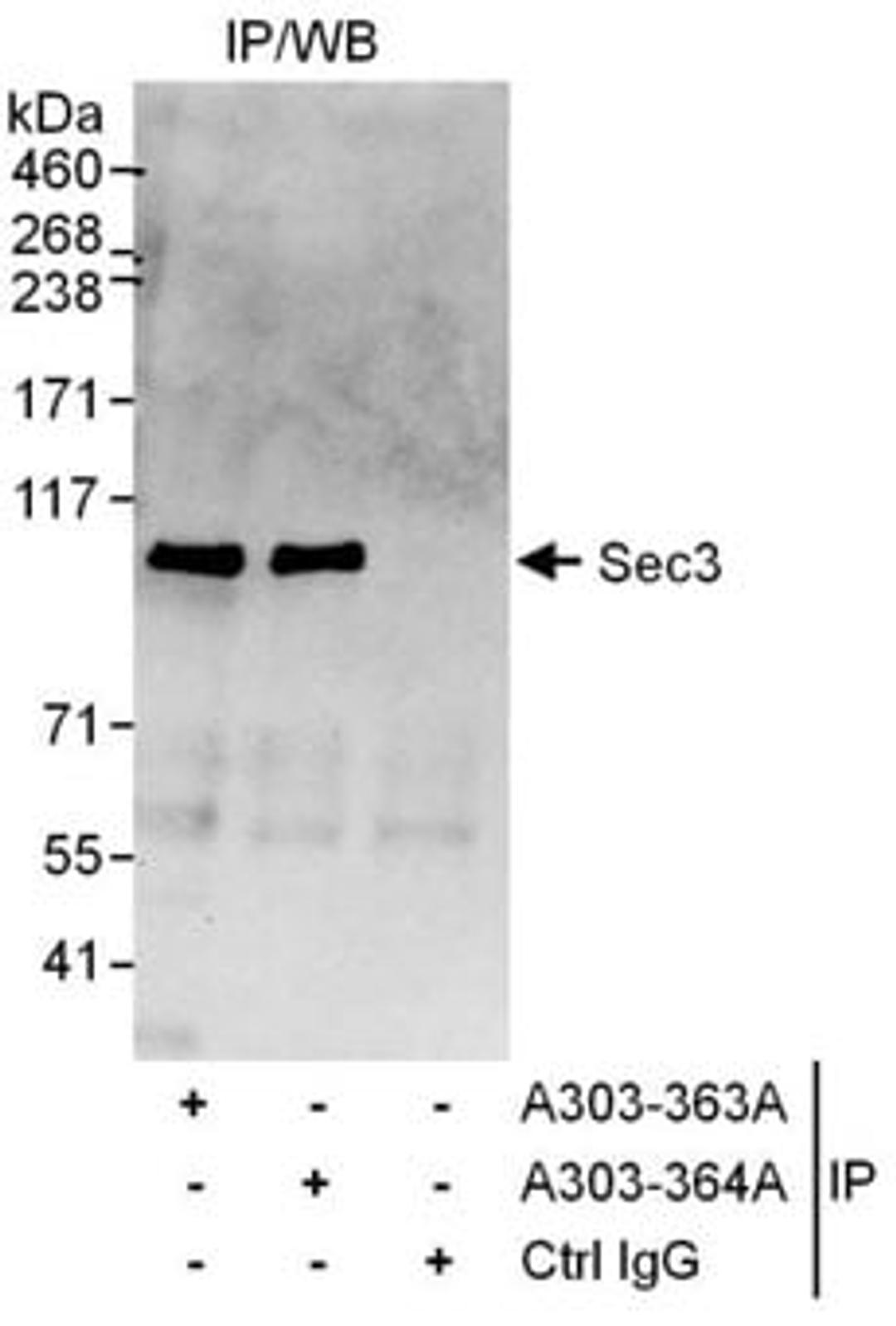 Detection of human Sec3 by western blot of immunoprecipitates.