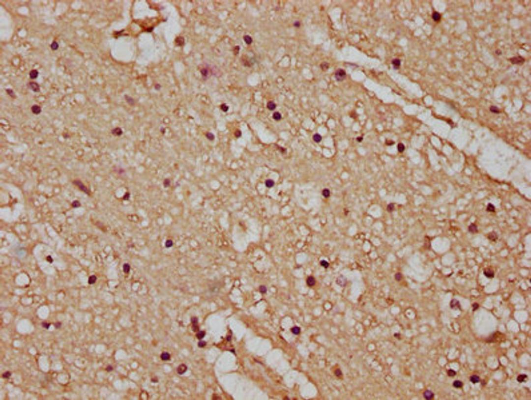 IHC image of CSB-PA23389A0Rb diluted at 1:100 and staining in paraffin-embedded human brain tissue performed on a Leica BondTM system. After dewaxing and hydration, antigen retrieval was mediated by high pressure in a citrate buffer (pH 6.0). Section was blocked with 10% normal goat serum 30min at RT. Then primary antibody (1% BSA) was incubated at 4°C overnight. The primary is detected by a biotinylated secondary antibody and visualized using an HRP conjugated SP system.