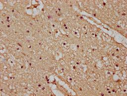 IHC image of CSB-PA23389A0Rb diluted at 1:100 and staining in paraffin-embedded human brain tissue performed on a Leica BondTM system. After dewaxing and hydration, antigen retrieval was mediated by high pressure in a citrate buffer (pH 6.0). Section was blocked with 10% normal goat serum 30min at RT. Then primary antibody (1% BSA) was incubated at 4°C overnight. The primary is detected by a biotinylated secondary antibody and visualized using an HRP conjugated SP system.