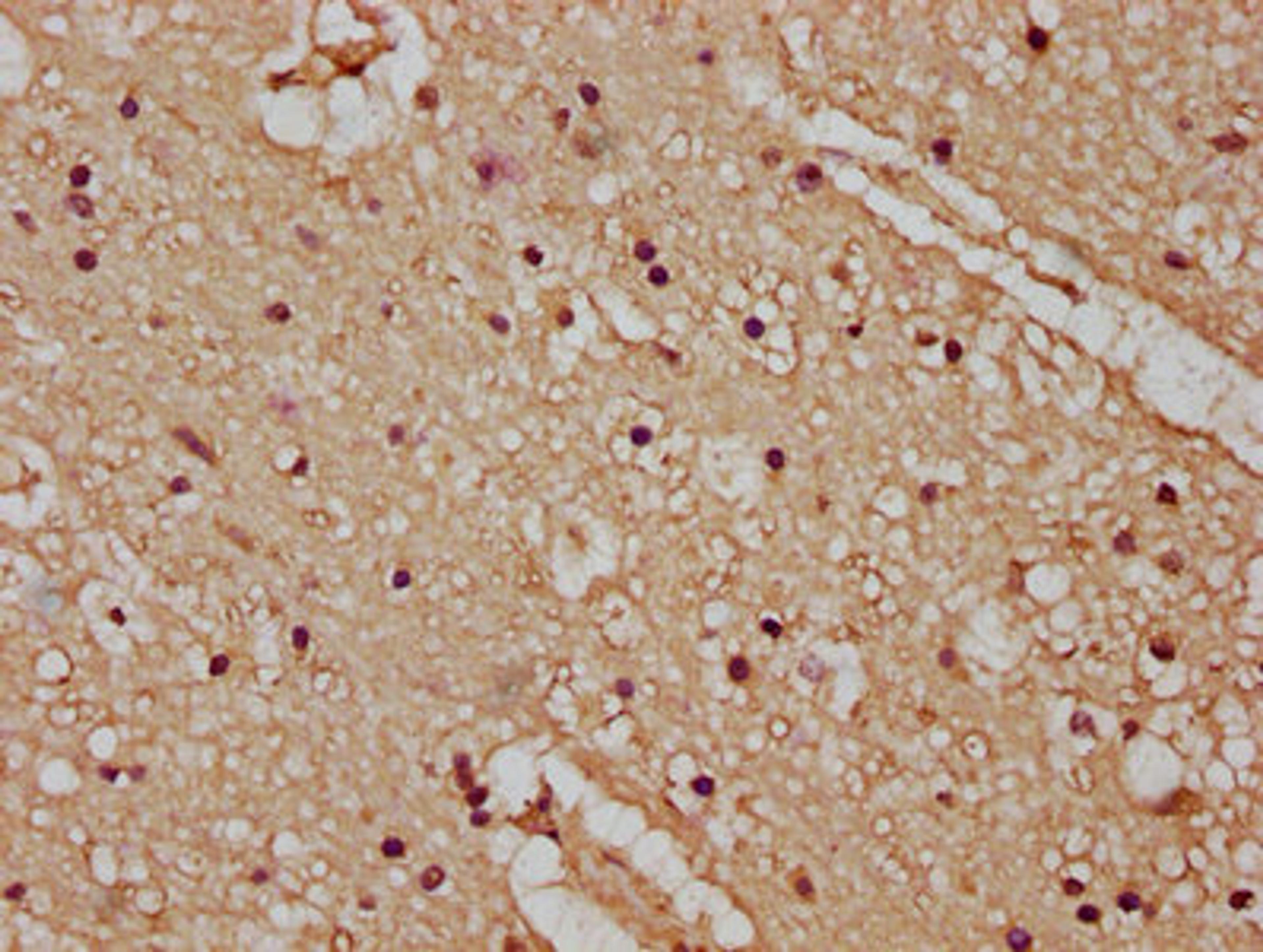 IHC image of CSB-PA23389A0Rb diluted at 1:100 and staining in paraffin-embedded human brain tissue performed on a Leica BondTM system. After dewaxing and hydration, antigen retrieval was mediated by high pressure in a citrate buffer (pH 6.0). Section was blocked with 10% normal goat serum 30min at RT. Then primary antibody (1% BSA) was incubated at 4°C overnight. The primary is detected by a biotinylated secondary antibody and visualized using an HRP conjugated SP system.