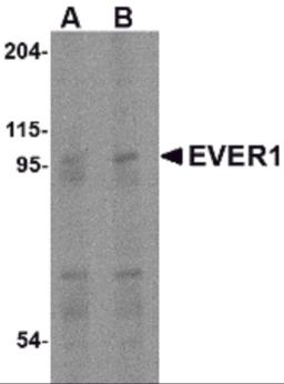 Western blot analysis of EVER1 in human spleen tissue lysate with EVER1 antibody at (A) 1 and (B) 2 &#956;g/mL.