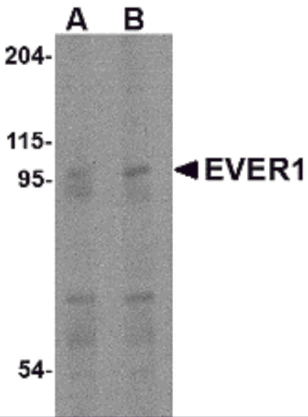 Western blot analysis of EVER1 in human spleen tissue lysate with EVER1 antibody at (A) 1 and (B) 2 μg/mL.