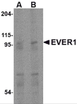 Western blot analysis of EVER1 in human spleen tissue lysate with EVER1 antibody at (A) 1 and (B) 2 μg/mL.