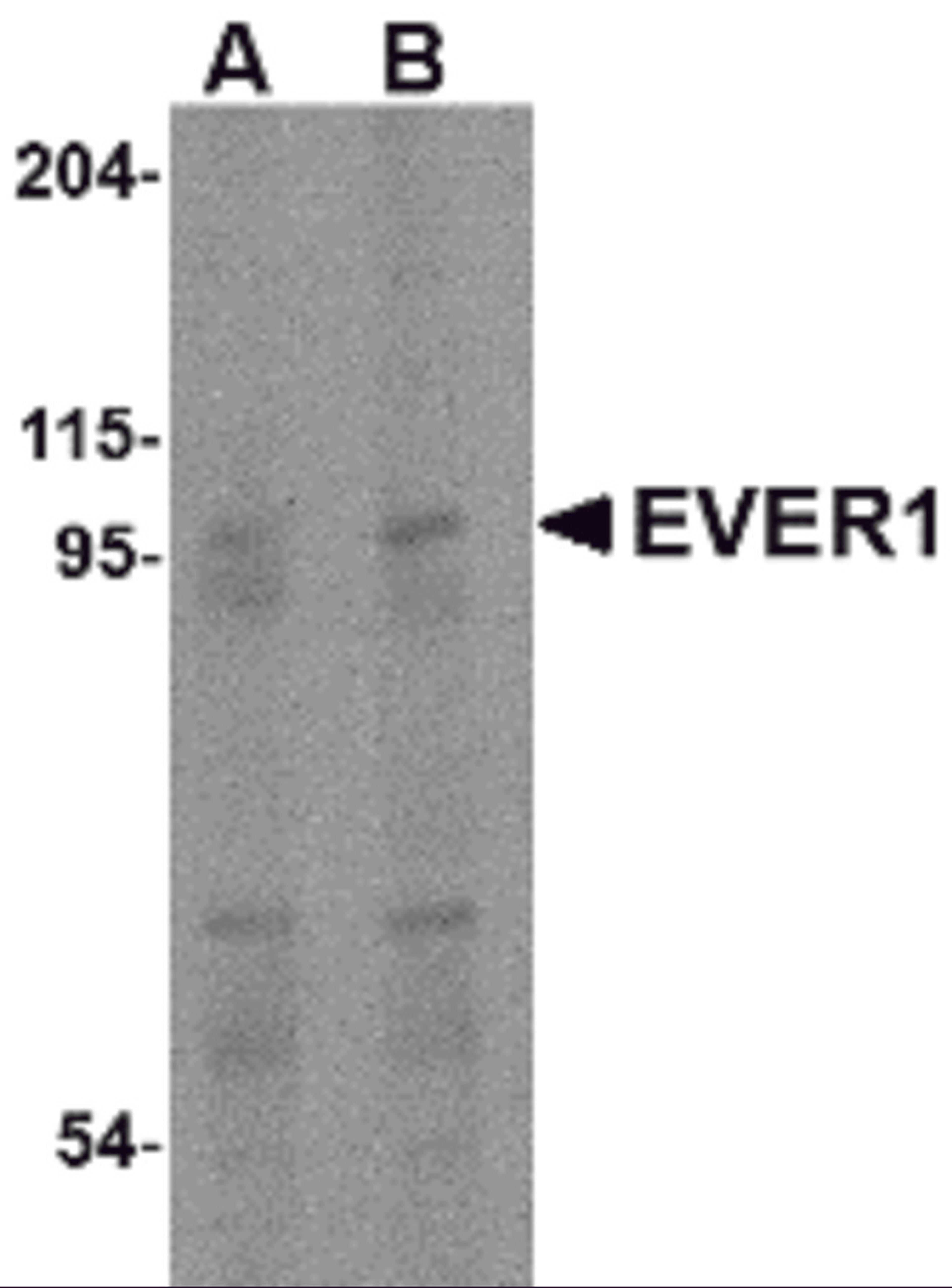 Western blot analysis of EVER1 in human spleen tissue lysate with EVER1 antibody at (A) 1 and (B) 2 μg/mL.