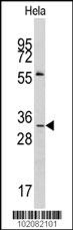 Western blot analysis of anti-MAGEA1 Antibody in Hela cell line lysates (35ug/lane).