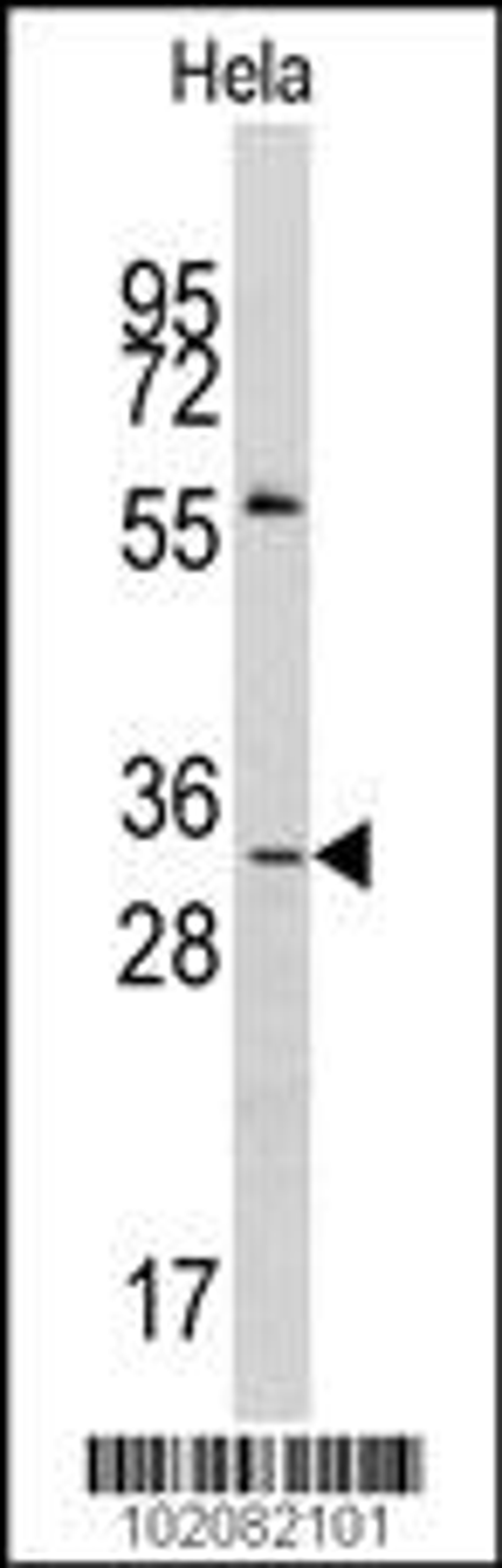 Western blot analysis of anti-MAGEA1 Antibody in Hela cell line lysates (35ug/lane).