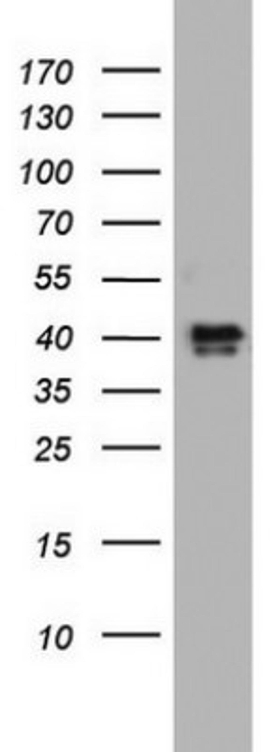 Western Blot: NRBF2 Antibody (1A2) [NBP2-46258] - Analysis of HT29 cell lysate (35ug).