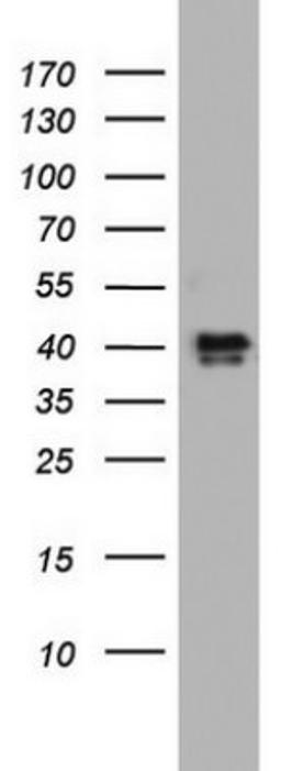 Western Blot: NRBF2 Antibody (1A2) [NBP2-46258] - Analysis of HT29 cell lysate (35ug).