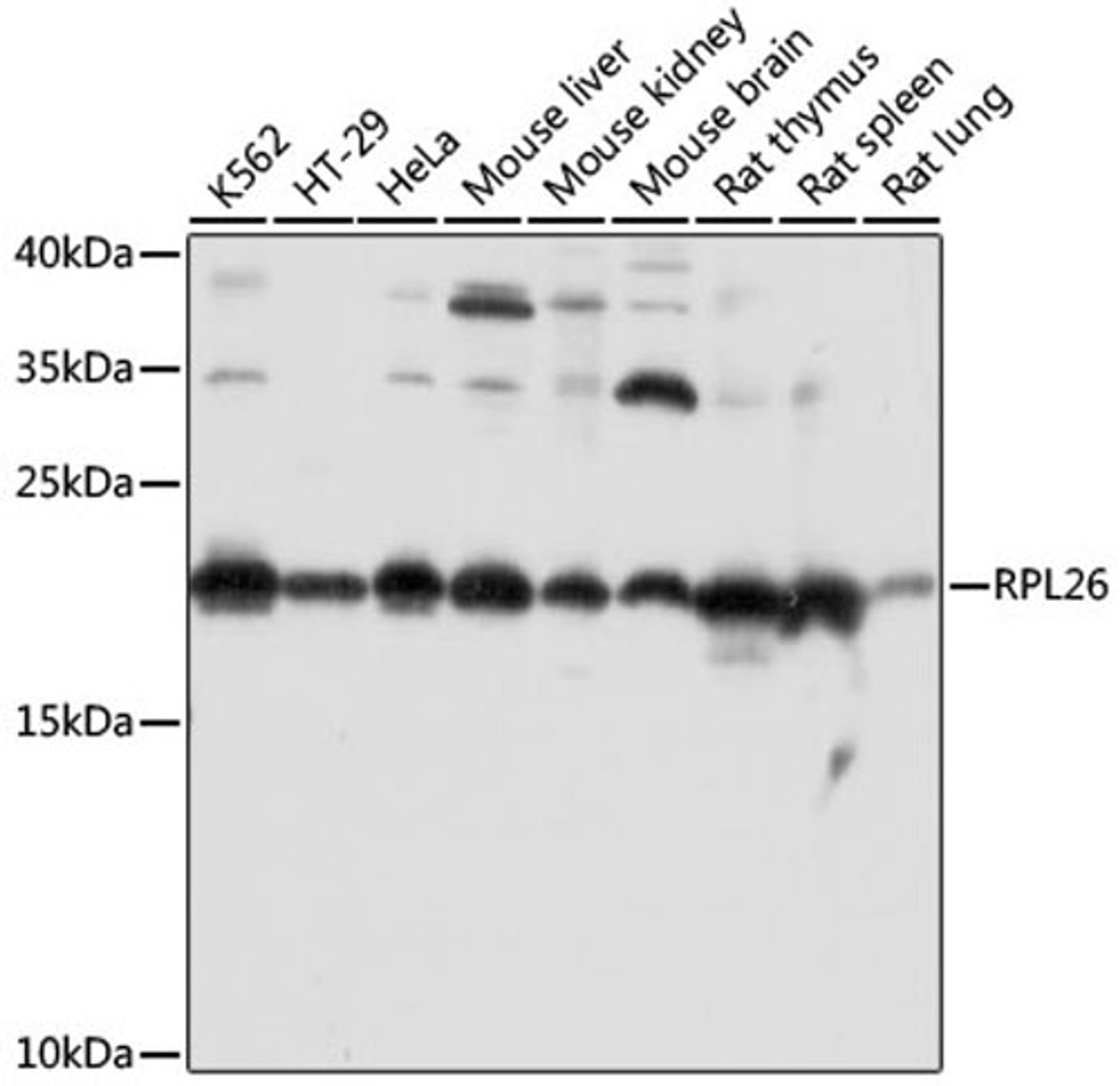 Western blot - RPL26 antibody (A16680)