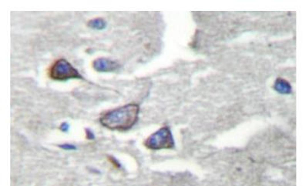 Immunohistochemistry: CDK5R1 Antibody [NB100-92383]