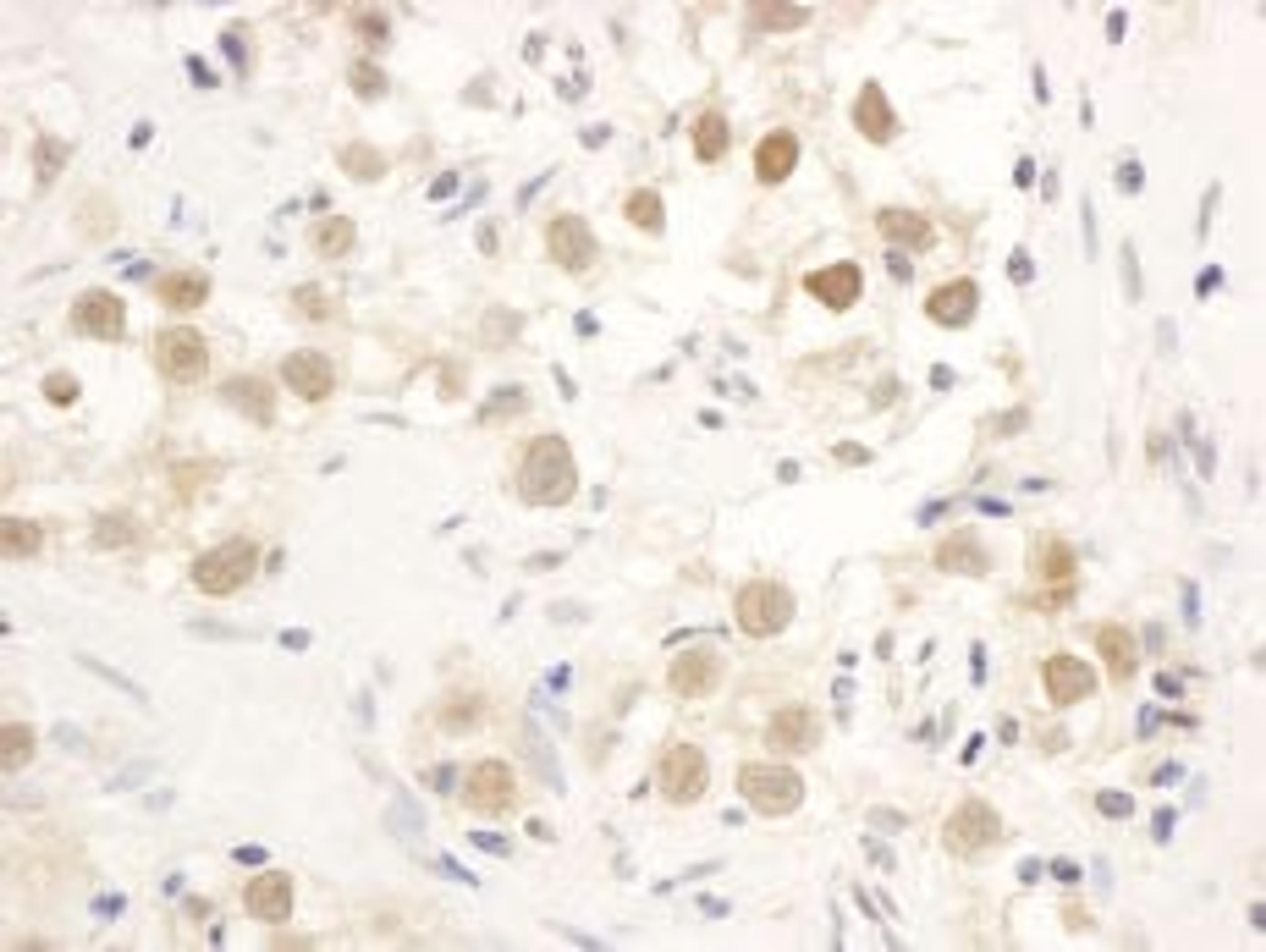 Detection of human CHK1 by immunohistochemistry.