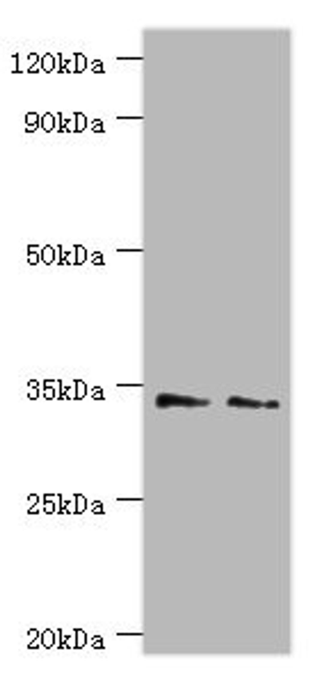 Western blot. All lanes: Killer cell immunoglobulin-like receptor 2DS4 antibody at 4ug/ml. Lane 1: K562 whole cell lysate. Lane 2: Jurkat whole cell lysate. Secondary. Goat polyclonal to rabbit IgG at 1/10000 dilution. Predicted band size: 34 kDa. Observed band size: 34 kDa.