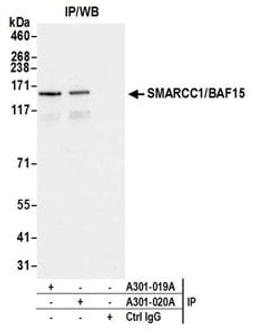 Detection of human SMARCC1/BAF155 by western blot of immunoprecipitates.